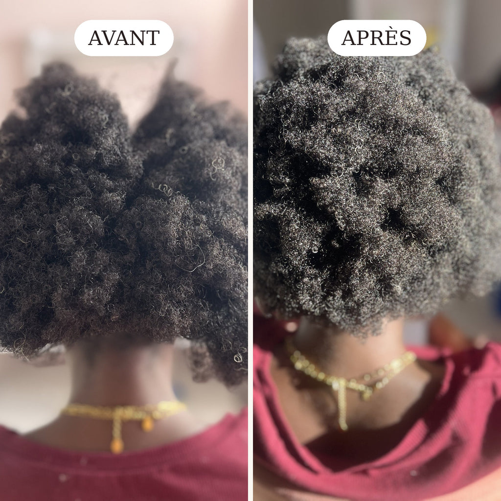 Avant-après avec le Coffret Hydratation et Nutrition Maison Nausikaa